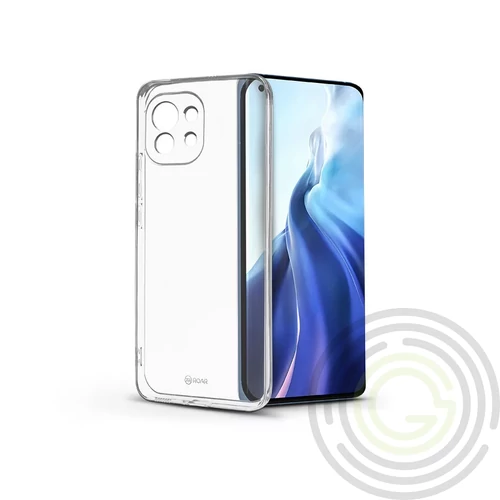 Roar All Day Xiaomi Mi 11 szilikon hátlap -  Full 360 - transparent
